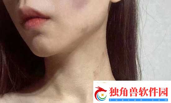 红雅典娜LIYA死了吗