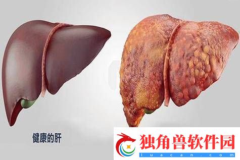 老公每天吃我小花园会伤肝吗：探讨健康饮食中的花草养生