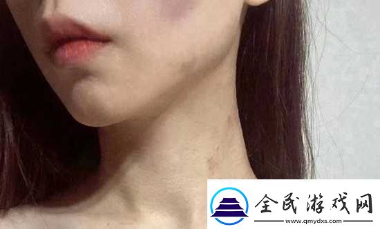 红雅典娜LIYA死了吗