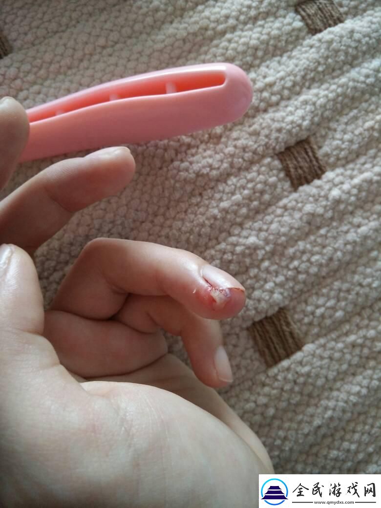 手肉异物