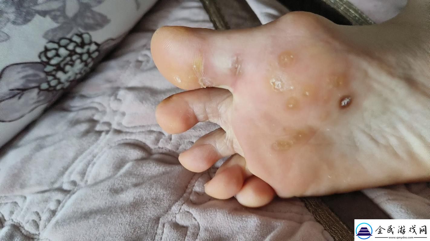 硬核新星疙瘩里的秘密