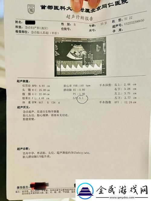 “OVO食肉族报告4”：创新狂潮下的热点解析